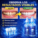 TRUERILIEF DENTITE PRO 2x1 -  ¡Repara Caries, Fortalece tu Esmalte y Recupera una Sonrisa Perfecta HOY!